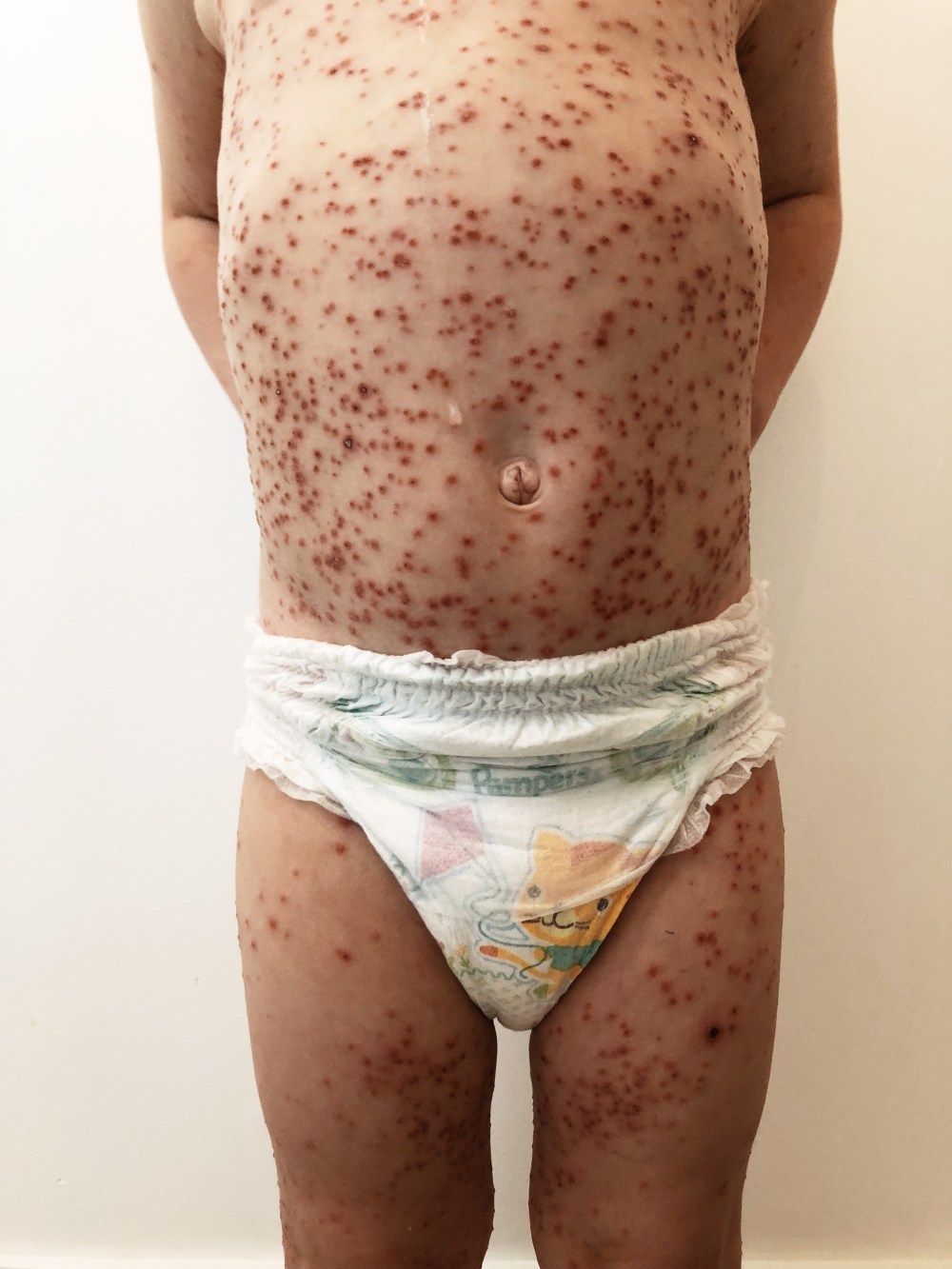 Processed with VSCO with s2 preset